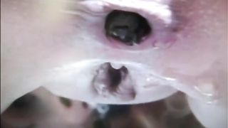 Woman shit and piss closeup