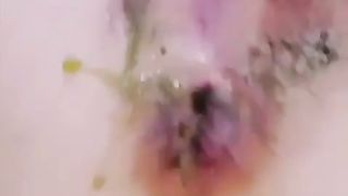 Korean girl scat anal candy