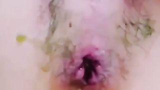 Korean girl scat anal candy