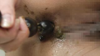 Japanese girl poop masturbation with vibrator