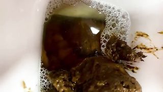 Hairy pussy babe pooping in the toilet