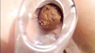 Crazy milf in lingerie put speculum in her ass and shitting