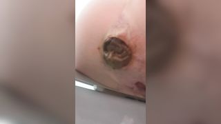 Long shit gaping hole closeup