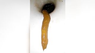 Deep closeup of pooping asshole