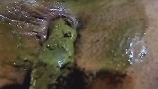 Shit covered asshole closeup
