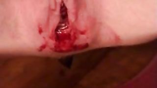 Chick in braces pooping on the couch