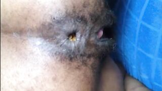 Hairy asshole ebony lady shits