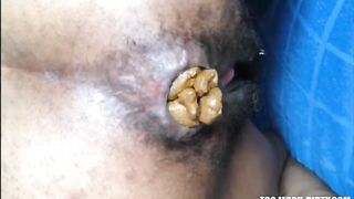 Hairy asshole ebony lady shits