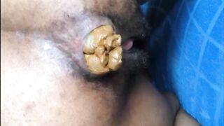 Hairy asshole ebony lady shits