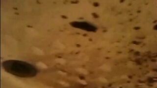 Woman shitting a very liquid diarrhea