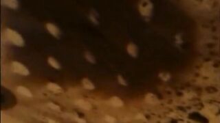 Woman shitting a very liquid diarrhea