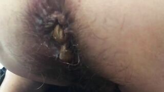 Up close asshole with brown shit and piss dripping out the crack