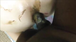 Interracial anal scat fucking