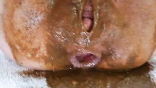 Dirty ass covered in shit