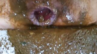 Dirty ass covered in shit