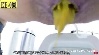 Loose motions Mix Show