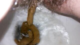 Hairy wife poop closeup