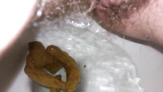 Hairy wife poop closeup
