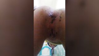 Ass fingering and fisting-closeup