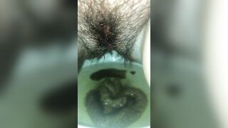 Hairy Poop and Pee super closeup