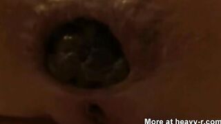 POV closeup of hard turd