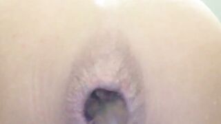 Asshole puking fresh turd