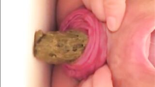 Hot Prolapsed anus milf shitting