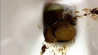 Hairy milf spreading pussy lips for shitting