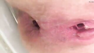 Pink asshole and black turd