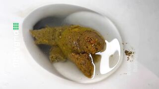 Toilet Squat Shit From Brooklyn