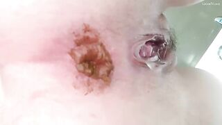 Girl with shit-filled ass and pussy gets fucked with dildo