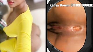 Kenya Brown Constipation poo
