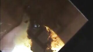 Woman takes a long, nasty shit on a toilet