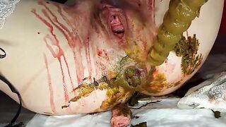 Woman with shit and blood on her ass and thighs