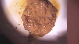 She shits diarrhea and pisses on her period