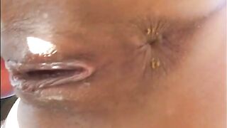 A woman has her asshole stretched open