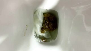 Stubborn and Stuck Poop