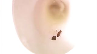 Amateur lady Feona poops in closeup