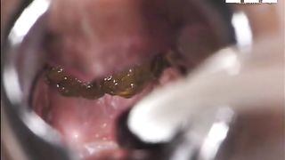 inside asshole speculum closeup