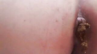 Chubby fat pussy lady pissing and pooping in closeup