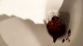 Cute hot ass girl and her sticky poop closeup