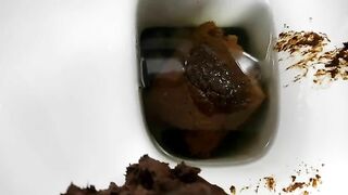 Beautiful anus stretched Closeup