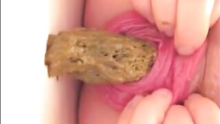 Prolapsed anus milf shitting