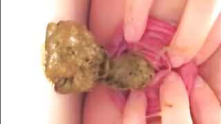 Prolapsed anus milf shitting