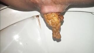 Yellow stinky poop closeup