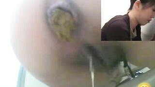 Dark Japanese pooping asshole
