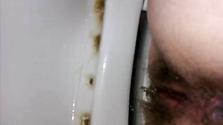 Hairy asshole pooping POV hole