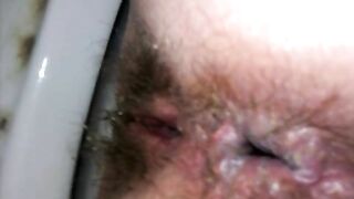 Hairy asshole pooping POV hole