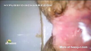Hairy pussy lady piss and poop closeup