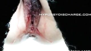 Bloody Piss And Shit Closeup